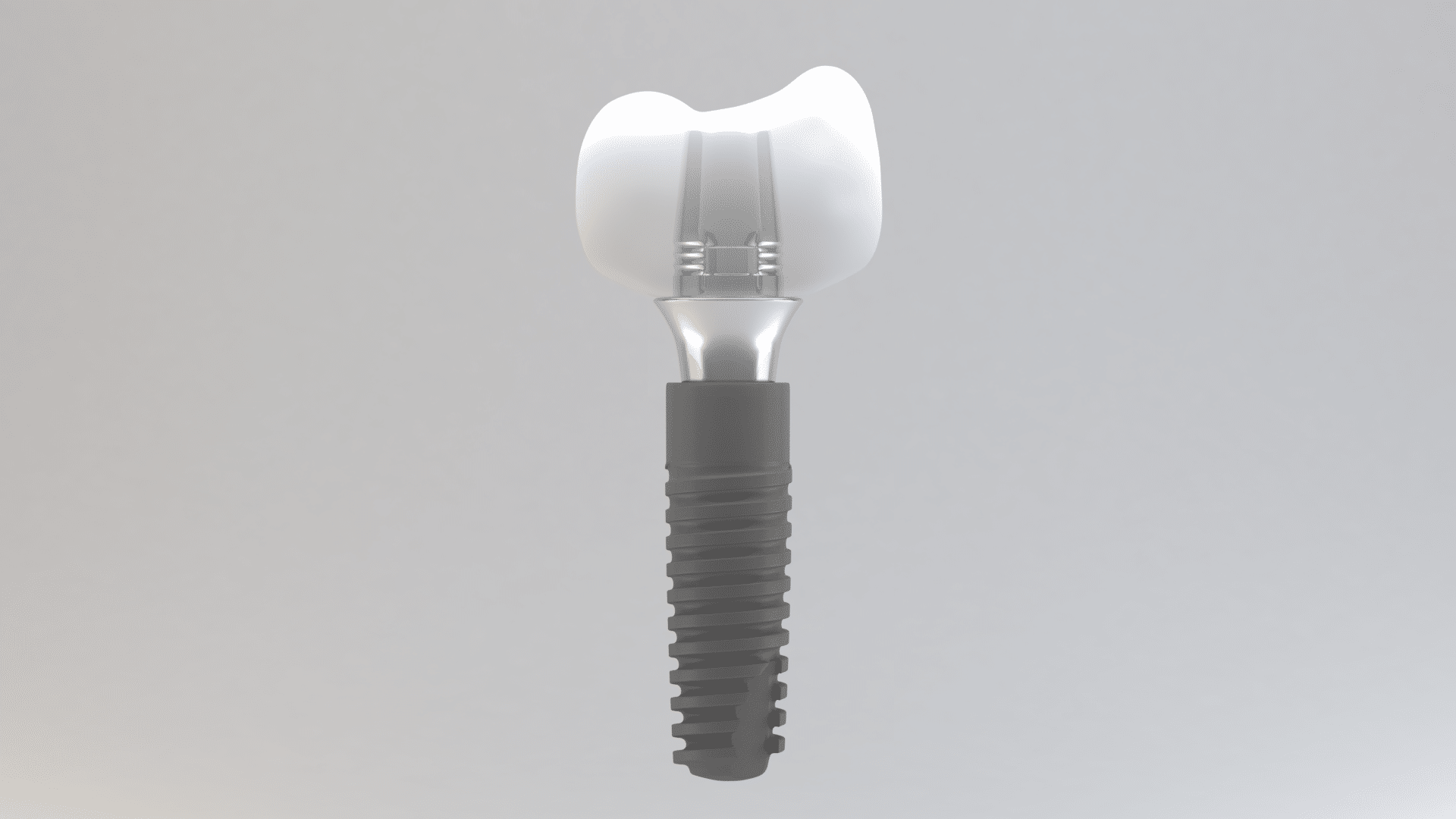 Implante dental con corona sobre implante en modelo 3D